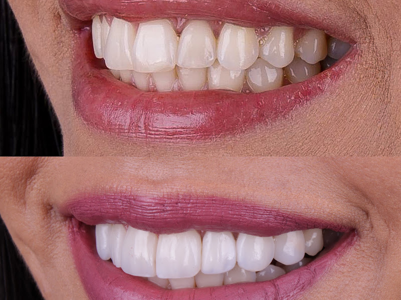 Foto 9 de IOA Rio de Janeiro