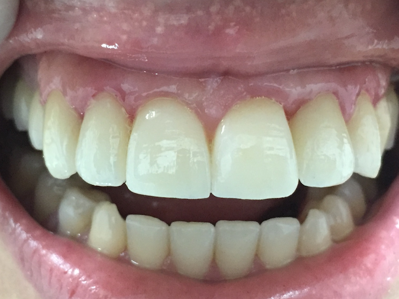 Foto 5 de IOI Santé Unidade São Judas - Dentista Zona Sul de SP