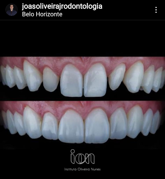 Foto 2 de ION-Instituto Oliveira Nunes de odontologia