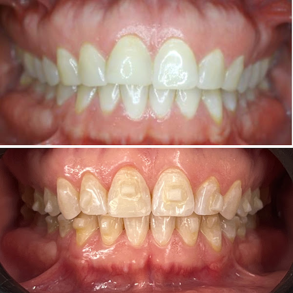 Foto 2 de IOP Instituto Odontológico da Paralela