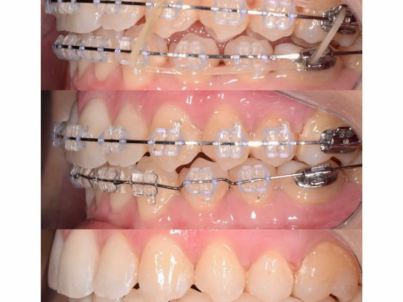 Foto 2 de IOPA-Instituto Odontológico do Pará