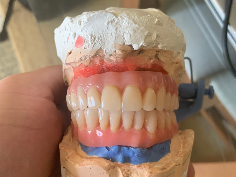 Foto 3 de IOPA-Instituto Odontológico do Pará