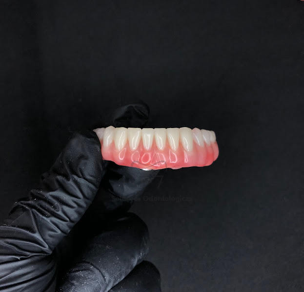 Foto 2 de IP7 Soluções Odontológicas - Especialistas em protocolos acrílicos, prótese total, digital e cerâmica.