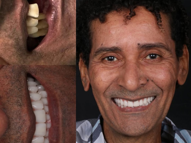 Foto 10 de IRF Odontologia