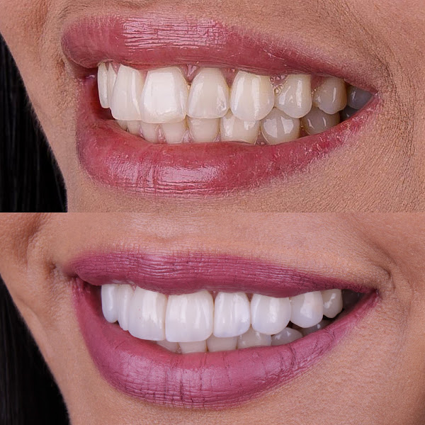 Foto 2 de IRio Odontologia - Clínica Odontológica na Barra da Tijuca