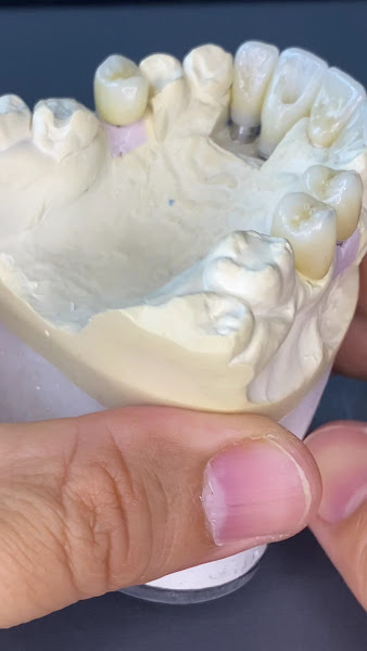 Foto 3 de IRO Instituto de Reabilitação Oral