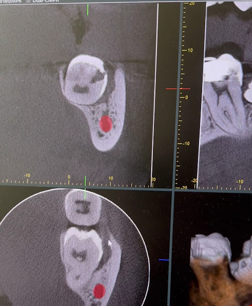 Foto 3 de Irto - Instituto de Radiologia e Tomografia Oral