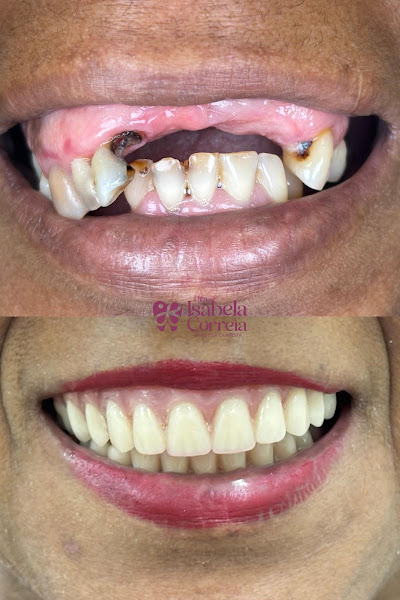 Foto 3 de Isabela Correia | Cirurgiã-Dentista | Ortodontista | Saguaçu - Joinville