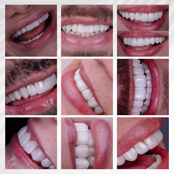 Foto 2 de Isabela Vaz - Odontologia Estética e Reabilitadora