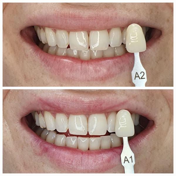 Foto 2 de Isabella Chmilouski Odontologia
