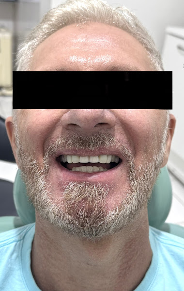 Foto 3 de Ishikawa Odontologia - Dentista Campinas