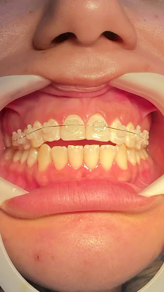 Foto 3 de Iso Campinas