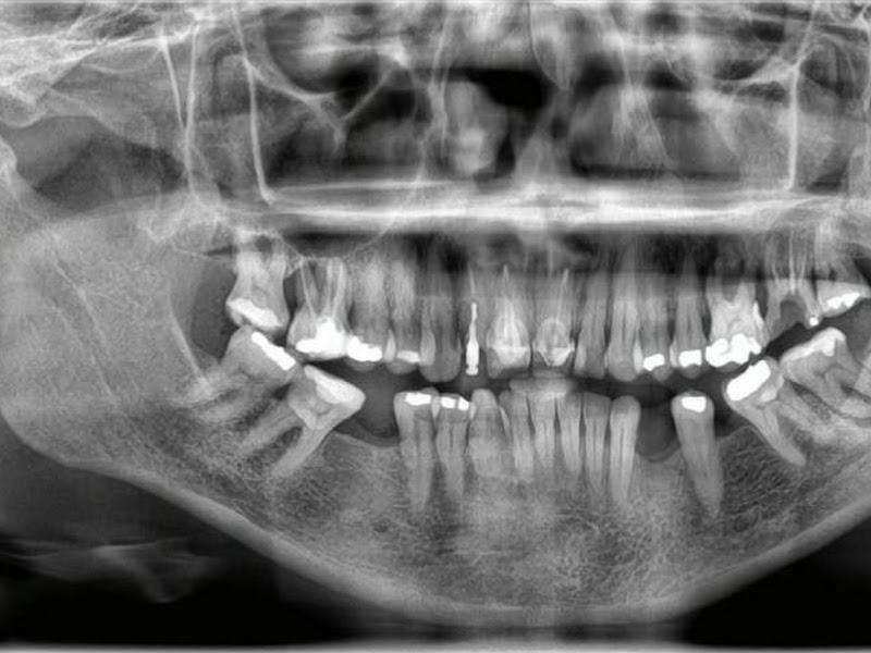 Foto de ISUDENT CLÍNICA ODONTOLÓGICA - Cirurgia Bucomaxilofacial