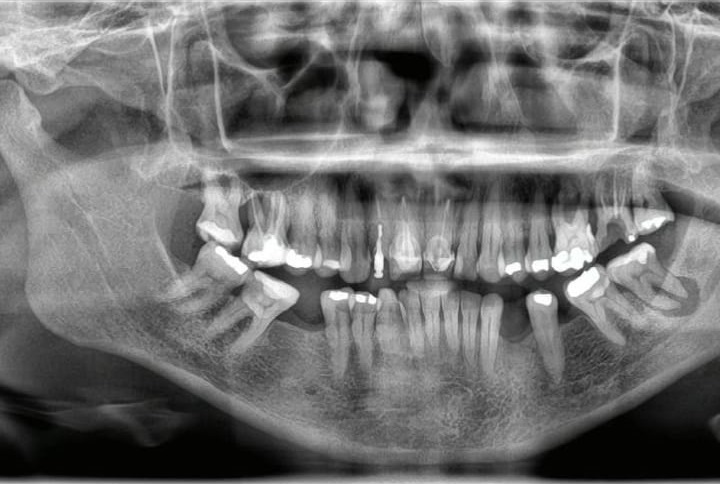 Foto 2 de ISUDENT CLÍNICA ODONTOLÓGICA - Cirurgia Bucomaxilofacial
