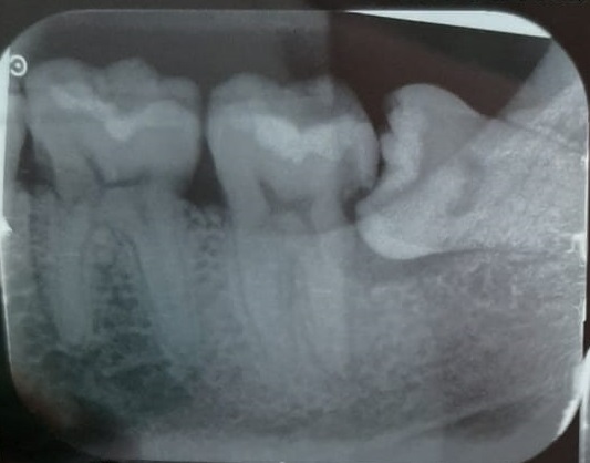 Foto 3 de ISUDENT CLÍNICA ODONTOLÓGICA - Cirurgia Bucomaxilofacial