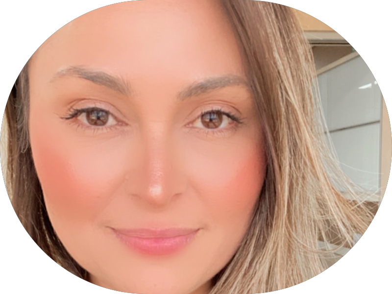 Foto 7 de IT Odontologia | Invisalign e Estética Dental | Zona Leste SP