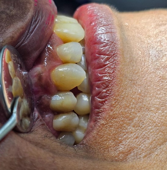 Foto 3 de ITABUNA Bahia Implantes Dra Ely Alcântara