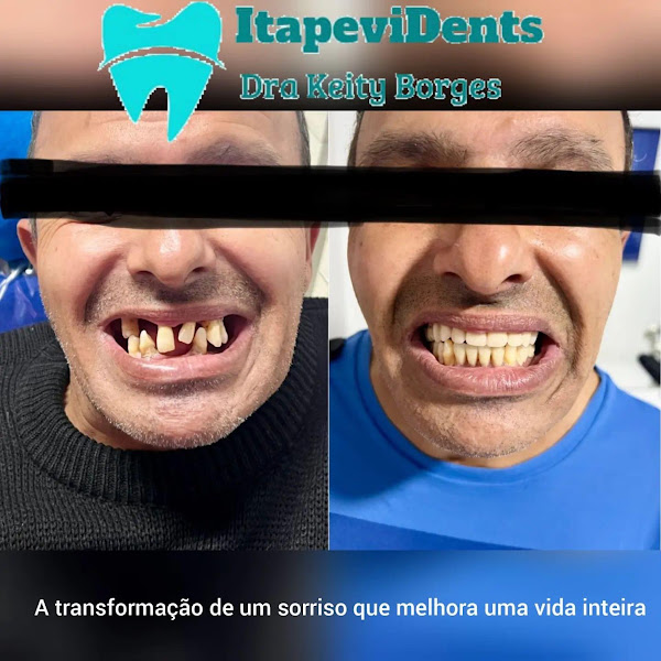 Foto 3 de ItapeviDents