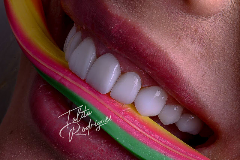 Foto 3 de ITR CLINIC- Odontologia e Harmonização Facial