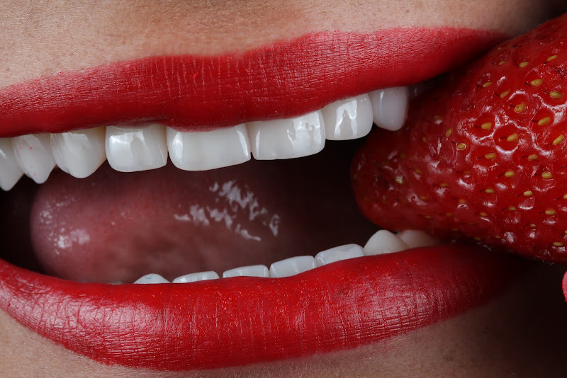 Foto 3 de Izabella Ribeiro Harmonização da Face e Sorriso