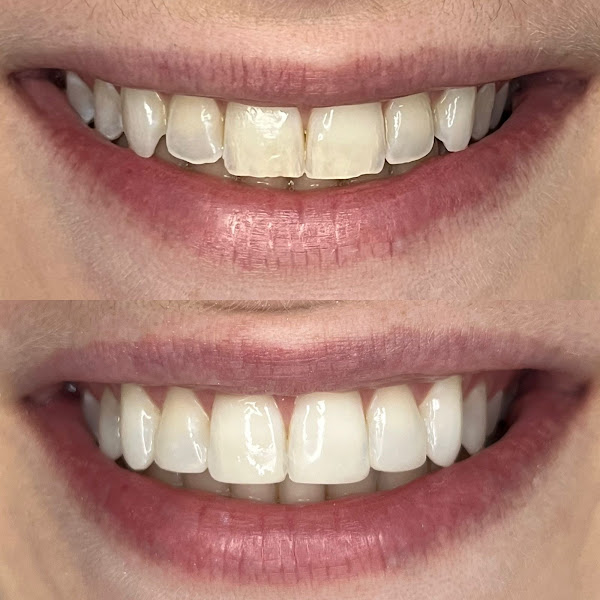 Foto 3 de IZG Odontologia Especializada | Alinhadores invisíveis | SouSmile | Ortodontia | Reabilitação Oral | Estética dental |