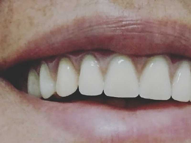 Foto 7 de Jacob odontologia