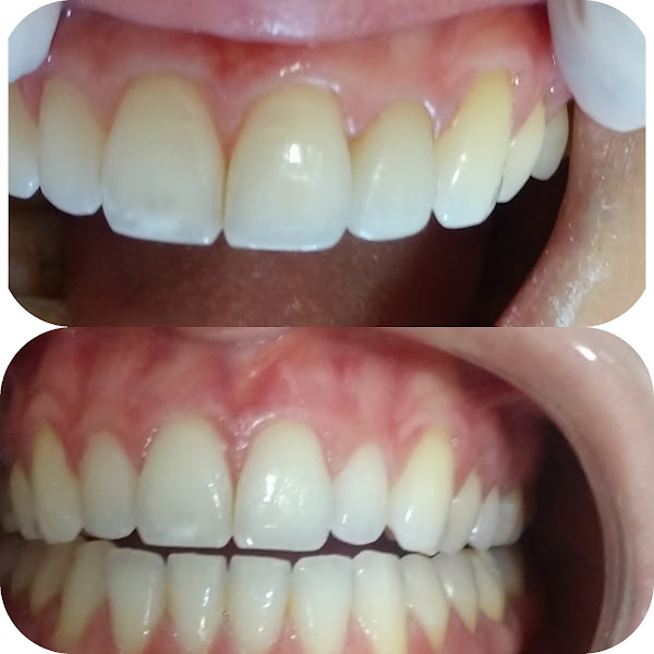 Foto 3 de Jaqueline Nigro - Dentista