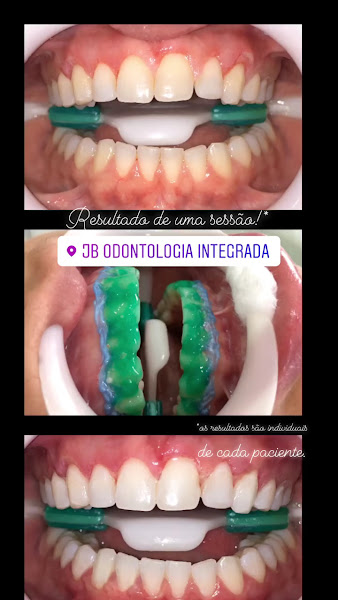 Foto 4 de JB Odontologia Integrada