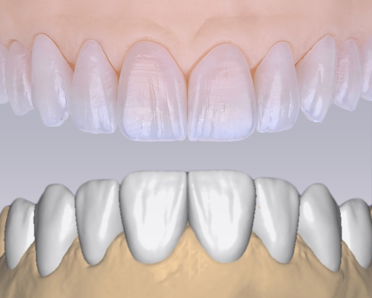 Foto 3 de JC Estética Dentária – Laboratório de Prótese
