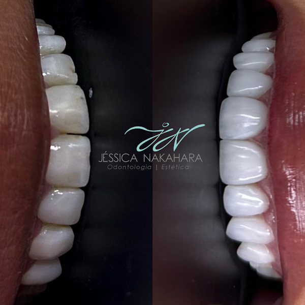 Foto 2 de Jessica Nakahara - Harmonização e Odontologia