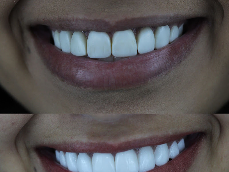 Foto 2 de João Bosco de Souza Oliveira