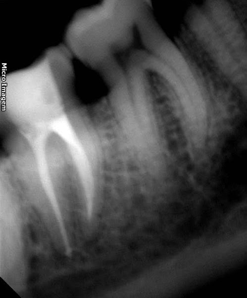 Foto 2 de Joao Melo Endodelivery