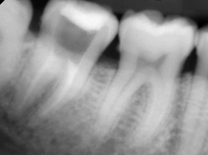 Foto 3 de Joao Melo Endodelivery