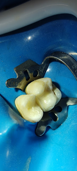 Foto 3 de João Timóteo - Dentista em Caruaru