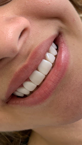 Foto 3 de JOGI Odontologia - Próteses Dentárias - Implantes - Facetas em resina - Odontopediatria em Pirituba