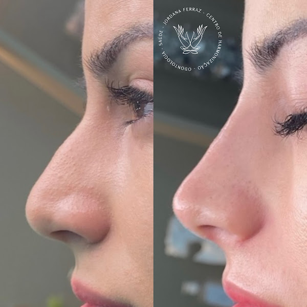 Foto 3 de Jordana Ferraz - Centro de Harmonização Facial e Saúde