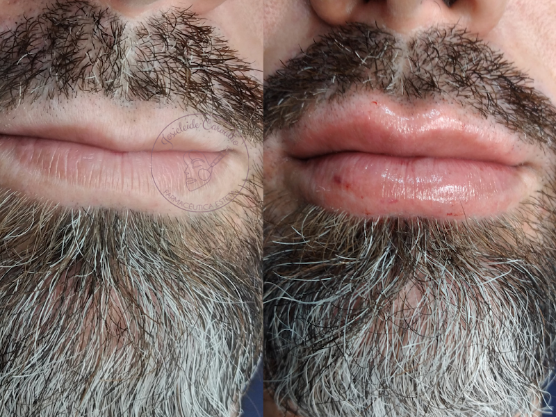 Foto 2 de Josi Carvalho