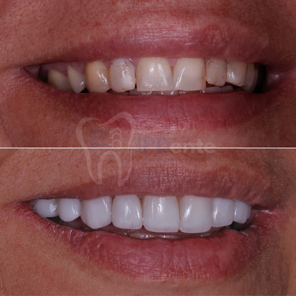 Foto 2 de JPDente - Odontologia
