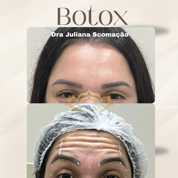 Foto 2 de Juliana Scomação Estética e Micropigmentação
