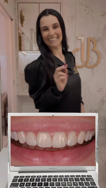 Foto 3 de Jussara Bernardon Odontologia Estética e Digital