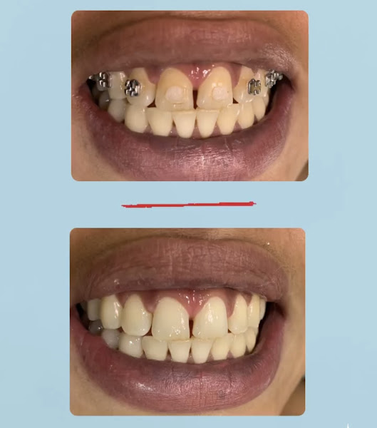 Foto 2 de Karen Bock / Dentista em Guarulhos