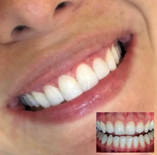 Foto 2 de Karina Macêdo Odontologia | Invisalign e Estética em Resina