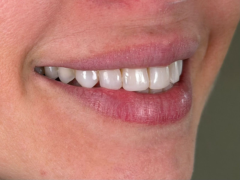 Foto 3 de Karla Koene Odontologia Estética - Innove Odonto