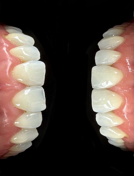 Foto 3 de Karolina Rezende - Estética Dental e Ortodontia - Dentista Juiz de Fora