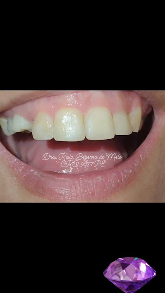 Foto 2 de Keila Melo | Odontologia e Estética