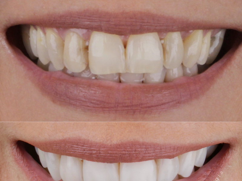 Foto 3 de Kéren Hapuque Odontologia e Estética
