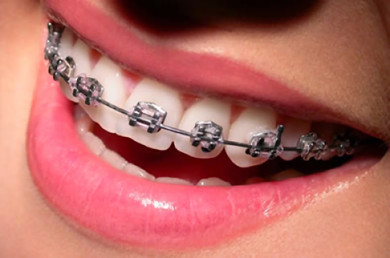 Foto 3 de Ki-Sorriso Odontologia e Saúde