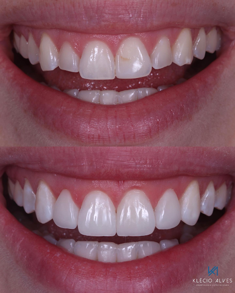 Foto 3 de Klécio Alves - Odontologia Especializada