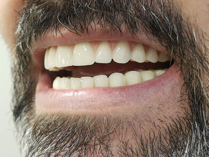 Foto 3 de Kletemberg Odontologia - Dr. Teobaldo Kletemberg - Dentista em Brusque - Implantes Dentários