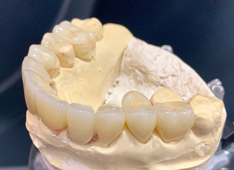 Foto 3 de Koi Protese Dentária